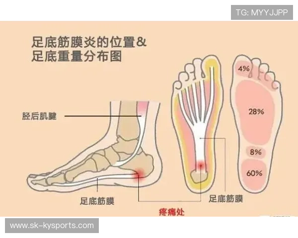 跑步后脚踝疼？2026 专业理疗师教你辨别是扭伤还是筋膜炎。，跑步后感觉脚踝脚筋肿